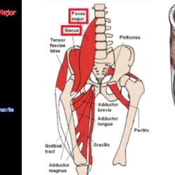 Hip Flexor Strains In Sports